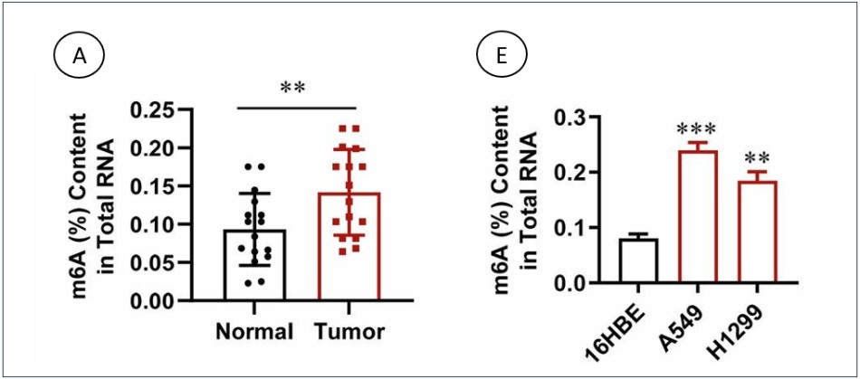 The Influence of m6A Methylation on Lung Cancer Outcomes